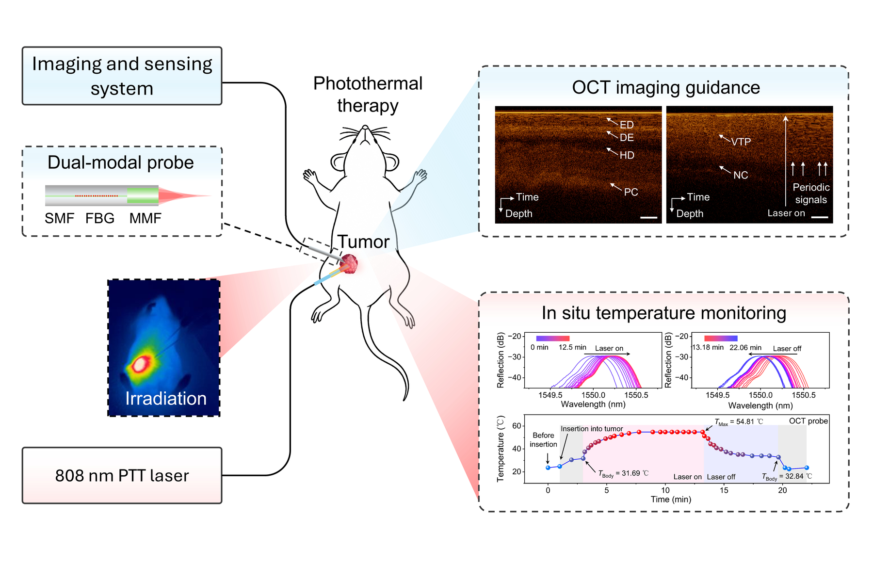 Dual-modal fiber needle probe for optical coherence tomography imaging and in situ temperature sensing